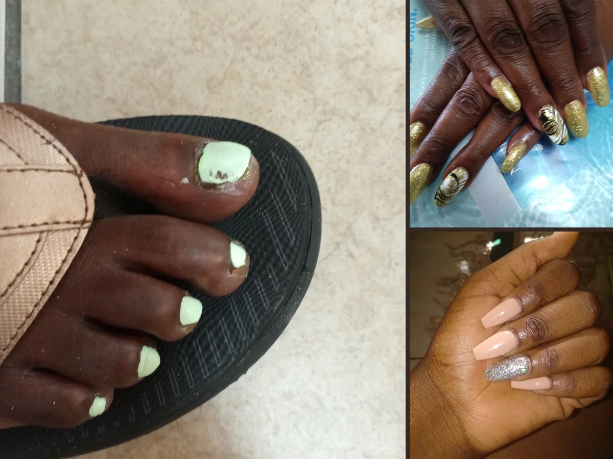 Nail Care in Orlando